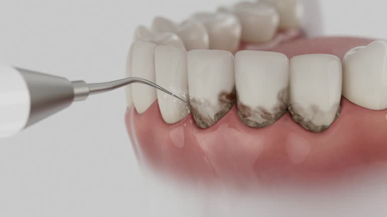 Reliable Emergency Dentist contractor in Spring Arbor, MI by Smile Center Dentistry